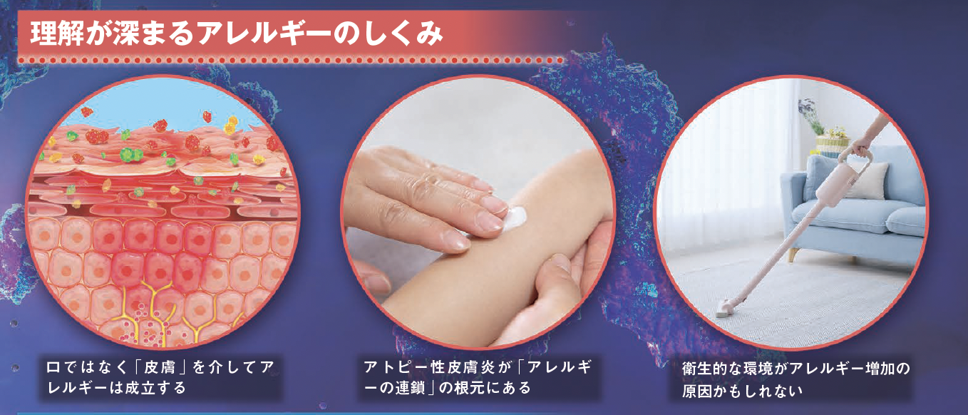 【アレルギーの今と昔】誰もが人事ではすまされない。多様化・複雑化するアレルギーの最新事情