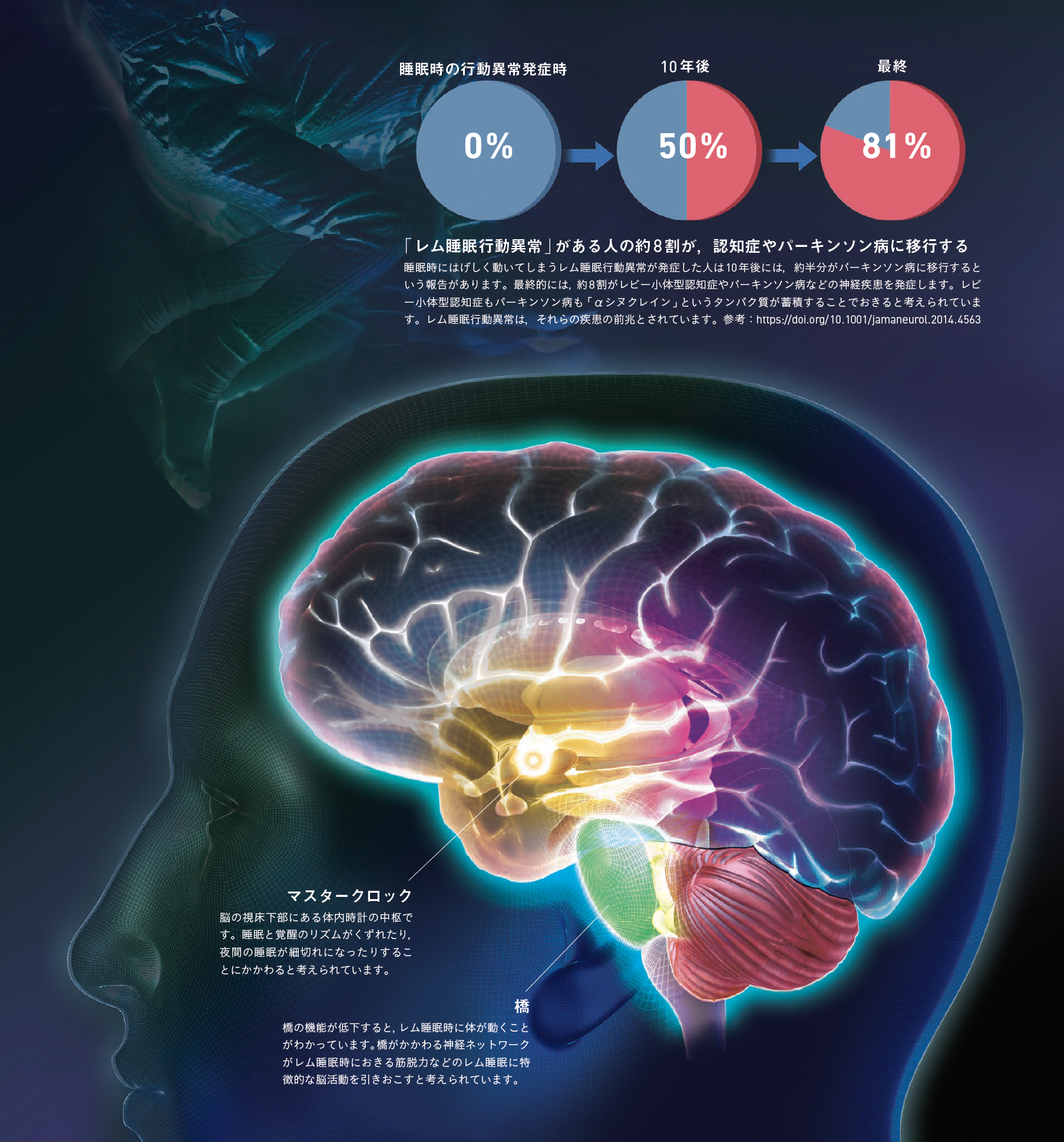 【睡眠】睡眠時に，はげしい言葉と動きがともなう場合，認知症の初期症状かもしれない