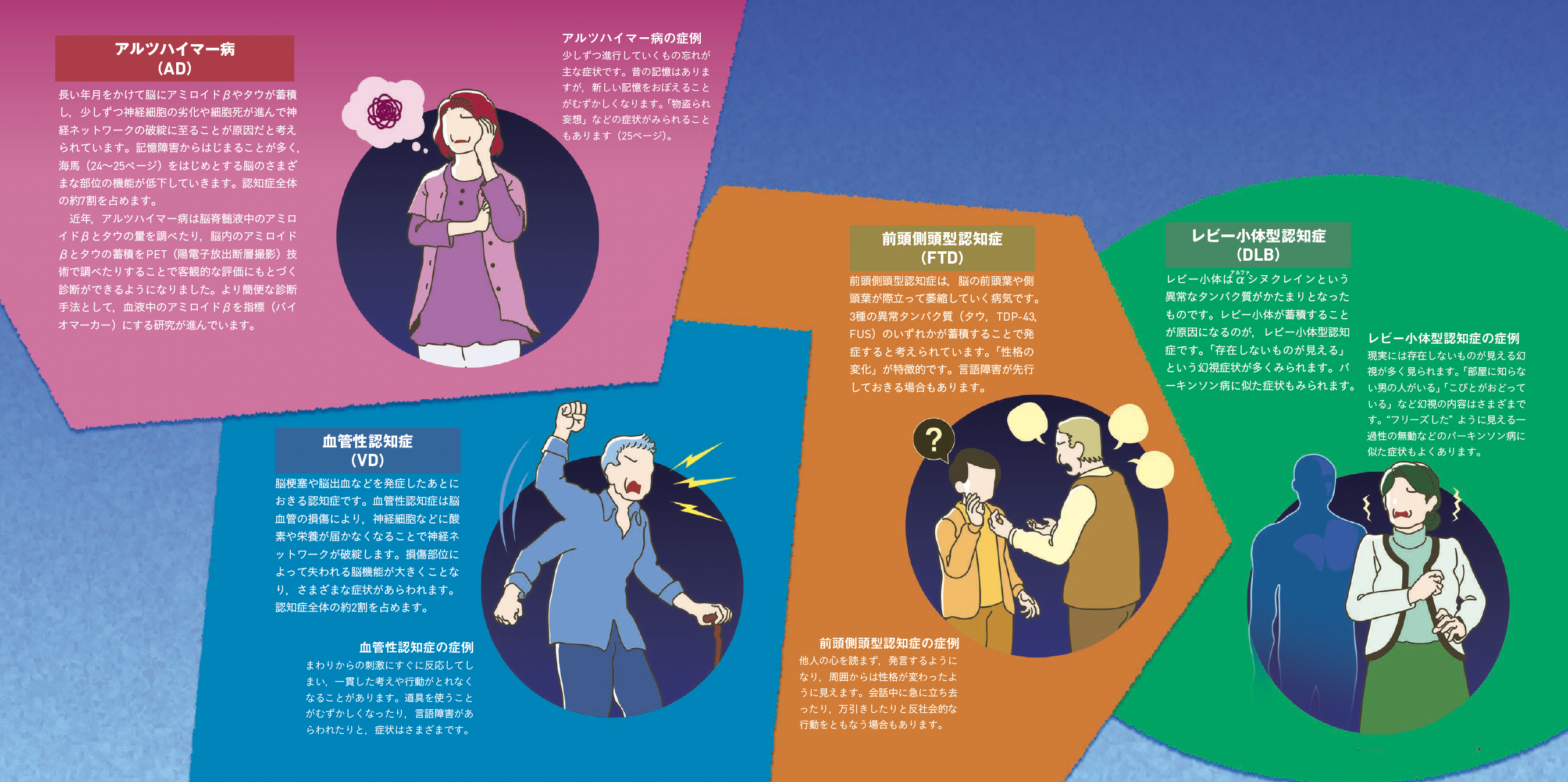 【認知症】神経ネットワークを破綻させる要因によって認知症は分類される