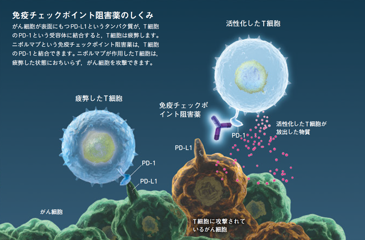 【肺がん】がんの中で死亡者数が最も多い肺がん─免疫細胞にはたらく薬で生存率が改善した